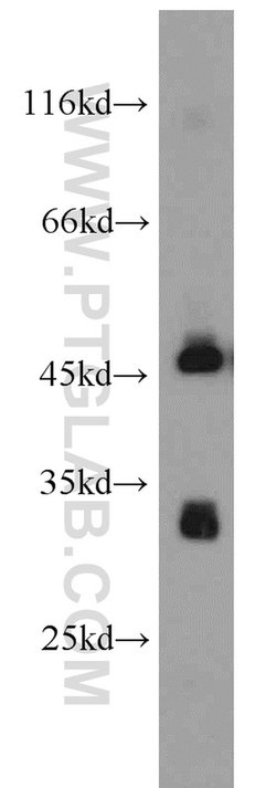 PDSS2 Rabbit anti-Human, Mouse, Rat, Polyclonal, Proteintech 150 &mu;L;