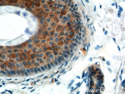 ST3GAL4 Rabbit anti-Human, Mouse, Rat, Polyclonal, Proteintech 150 &mu;L;