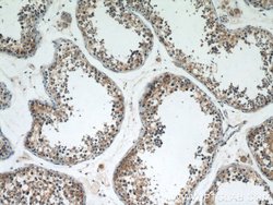 ST3GAL4 Rabbit anti-Human, Mouse, Rat, Polyclonal, Proteintech 150 &mu;L;