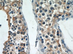 ST3GAL4 Rabbit anti-Human, Mouse, Rat, Polyclonal, Proteintech 150 &mu;L;