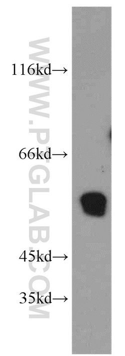 ST3GAL4 Rabbit anti-Human, Mouse, Rat, Polyclonal, Proteintech 150 &mu;L;