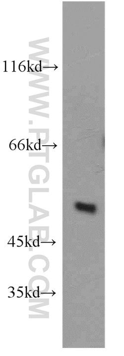 ST3GAL4 Rabbit anti-Human, Mouse, Rat, Polyclonal, Proteintech 150 &mu;L;