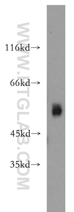 ST3GAL4 Rabbit anti-Human, Mouse, Rat, Polyclonal, Proteintech 150 &mu;L;