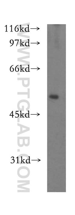 ST3GAL4 Rabbit anti-Human, Mouse, Rat, Polyclonal, Proteintech 150 &mu;L;