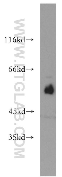 ST3GAL4 Rabbit anti-Human, Mouse, Rat, Polyclonal, Proteintech 150 &mu;L;