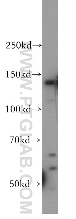 SFI1 Rabbit anti-Human, Mouse, Polyclonal, Proteintech:Antibodies:Primary