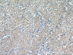 COG7 Rabbit anti-Human, Mouse, Rat, Polyclonal, Proteintech 150 &mu;L;