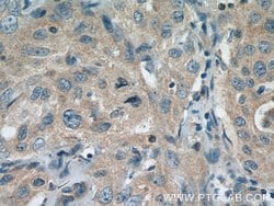 COG7 Rabbit anti-Human, Mouse, Rat, Polyclonal, Proteintech 150 &mu;L;