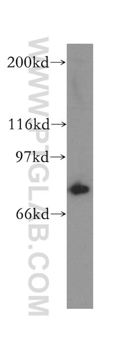 COG7 Rabbit anti-Human, Mouse, Rat, Polyclonal, Proteintech 150 &mu;L;