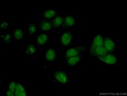PES1 Rabbit anti-Human, Mouse, Rat, Polyclonal, Proteintech 150 &mu;L;