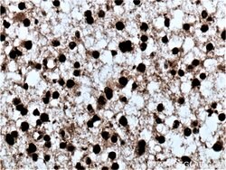 PES1 Rabbit anti-Human, Mouse, Rat, Polyclonal, Proteintech 150 &mu;L;
