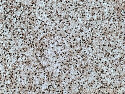 PES1 Rabbit anti-Human, Mouse, Rat, Polyclonal, Proteintech 150 &mu;L;