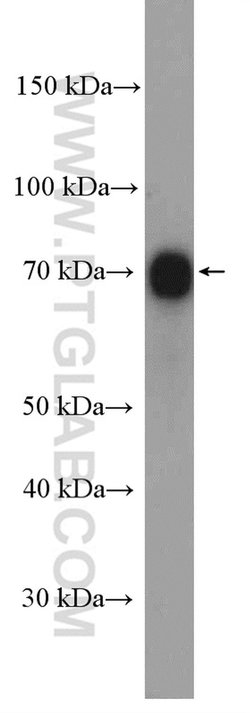 PES1 Rabbit anti-Human, Mouse, Rat, Polyclonal, Proteintech 150 &mu;L;