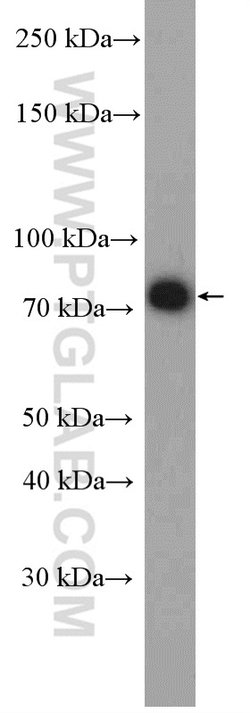 PES1 Rabbit anti-Human, Mouse, Rat, Polyclonal, Proteintech 150 &mu;L;