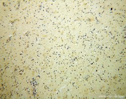 BRUNOL5 Rabbit anti-Human, Mouse, Rat, Polyclonal, Proteintech:Antibodies:Primary