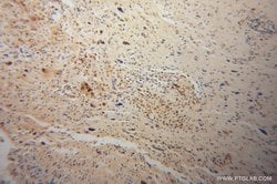 APC2 Rabbit anti-Human, Mouse, Rat, Polyclonal, Proteintech:Antibodies:Primary