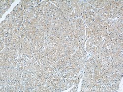 CYP2J2 Rabbit anti-Human, Mouse, Rat, Polyclonal, Proteintech:Antibodies:Primary