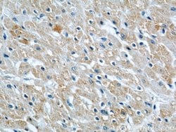 CYP2J2 Rabbit anti-Human, Mouse, Rat, Polyclonal, Proteintech:Antibodies:Primary