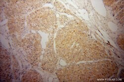 CYP2J2 Rabbit anti-Human, Mouse, Rat, Polyclonal, Proteintech:Antibodies:Primary