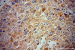 CYP2J2 Rabbit anti-Human, Mouse, Rat, Polyclonal, Proteintech:Antibodies:Primary
