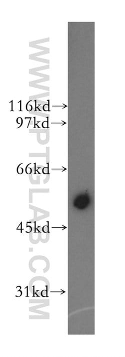 CYP2J2 Rabbit anti-Human, Mouse, Rat, Polyclonal, Proteintech:Antibodies:Primary