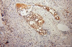 KHDRBS3 Rabbit anti-Human, Mouse, Rat, Polyclonal, Proteintech:Antibodies:Primary