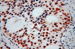 KHDRBS3 Rabbit anti-Human, Mouse, Rat, Polyclonal, Proteintech:Antibodies:Primary