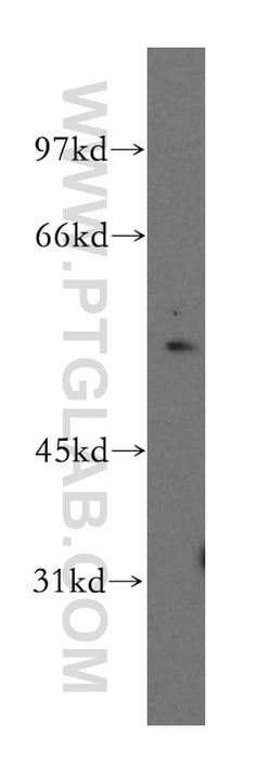 KHDRBS3 Rabbit anti-Human, Mouse, Rat, Polyclonal, Proteintech:Antibodies:Primary