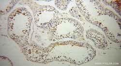 UBQLN3 Rabbit anti-Human, Mouse, Rat, Polyclonal, Proteintech 150 &mu;L;