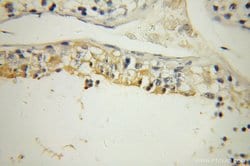 UBQLN3 Rabbit anti-Human, Mouse, Rat, Polyclonal, Proteintech 150 &mu;L;