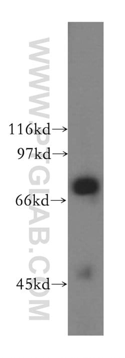 UBQLN3 Rabbit anti-Human, Mouse, Rat, Polyclonal, Proteintech 150 &mu;L;