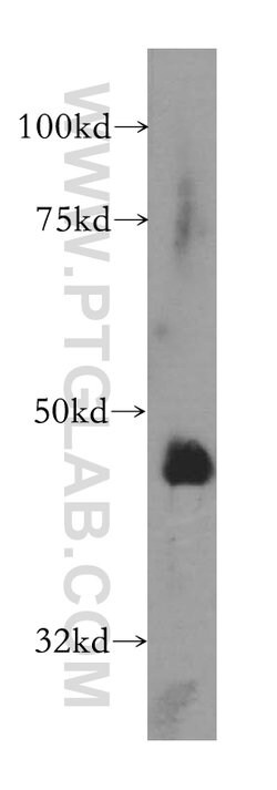 ARFGAP1 Rabbit anti-Human, Mouse, Rat, Polyclonal, Proteintech 150 &mu;L;