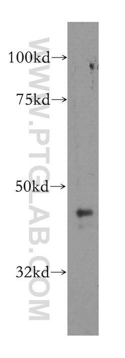 ARFGAP1 Rabbit anti-Human, Mouse, Rat, Polyclonal, Proteintech 150 &mu;L;