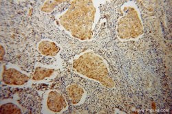 Proteintech ABCG1 Rabbit anti-Human, Mouse, Rat, Polyclonal, Proteintech