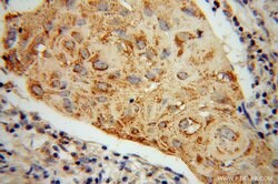 ABCG1 Rabbit anti-Human, Mouse, Rat, Polyclonal, Proteintech:Antibodies:Primary