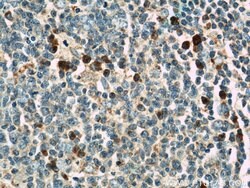 ABCG1 Rabbit anti-Human, Mouse, Rat, Polyclonal, Proteintech:Antibodies:Primary