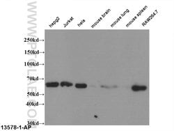 ABCG1 Rabbit anti-Human, Mouse, Rat, Polyclonal, Proteintech:Antibodies:Primary
