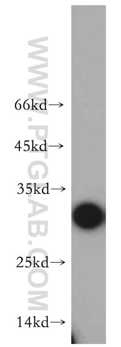PRDX6 Rabbit anti-Human, Mouse, Rat, Polyclonal, Proteintech 150 &mu;L;