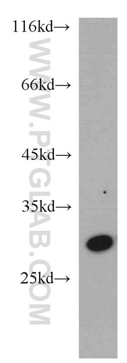 PRDX6 Rabbit anti-Human, Mouse, Rat, Polyclonal, Proteintech 150 &mu;L;