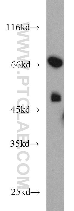 TXNDC3 Rabbit anti-Human, Mouse, Rat, Polyclonal, Proteintech 150 &mu;L;