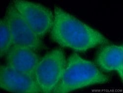 GZMB Rabbit anti-Human, Polyclonal, Proteintech:Antibodies:Primary Antibodies