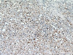 GZMB Rabbit anti-Human, Polyclonal, Proteintech:Antibodies:Primary Antibodies