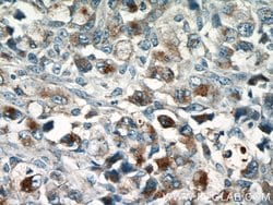 GZMB Rabbit anti-Human, Polyclonal, Proteintech:Antibodies:Primary Antibodies