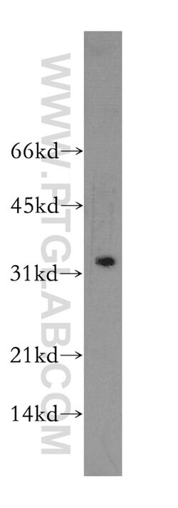 GZMB Rabbit anti-Human, Polyclonal, Proteintech:Antibodies:Primary Antibodies