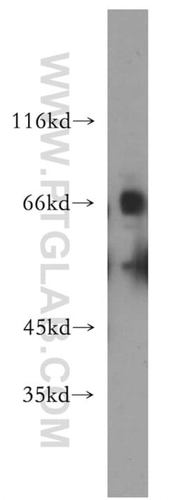 SLC22A2 Rabbit anti-Human, Mouse, Rat, Polyclonal, Proteintech:Antibodies:Primary