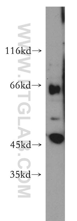 SLC22A2 Rabbit anti-Human, Mouse, Rat, Polyclonal, Proteintech:Antibodies:Primary
