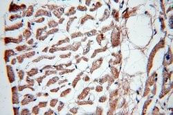 Tenascin-X Rabbit anti-Human, Mouse, Rat, Polyclonal, Proteintech:Antibodies:Primary