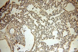 Tenascin-X Rabbit anti-Human, Mouse, Rat, Polyclonal, Proteintech:Antibodies:Primary