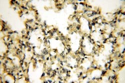 Tenascin-X Rabbit anti-Human, Mouse, Rat, Polyclonal, Proteintech:Antibodies:Primary
