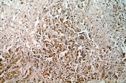 Tenascin-X Rabbit anti-Human, Mouse, Rat, Polyclonal, Proteintech:Antibodies:Primary